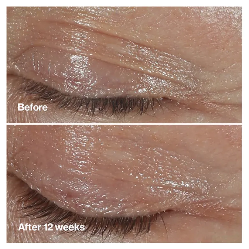 Clinique Smart Clinical Repair Wrinkle Correcting Eye Cream 0.5 oz